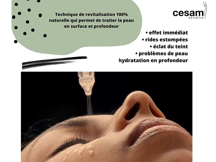 Résultats du Jet Peel