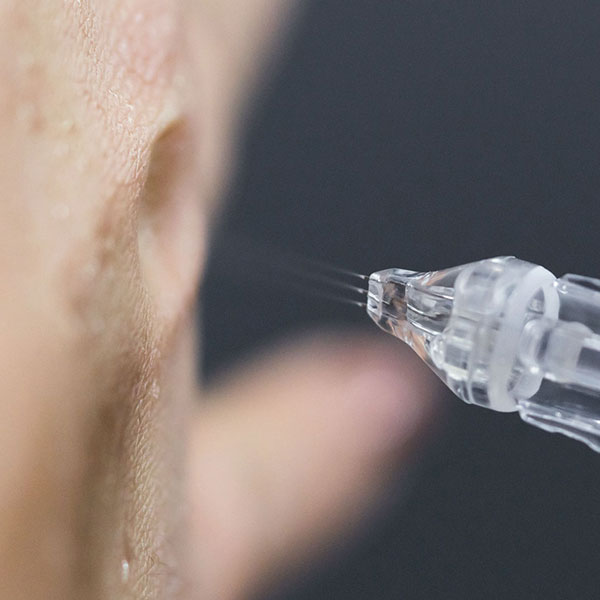 Comment se déroule un soin Jet Peel